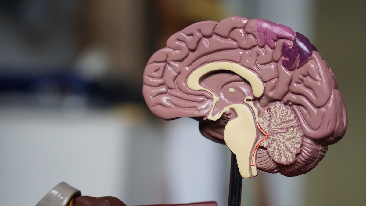 how does dementia affect the brain